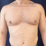after front