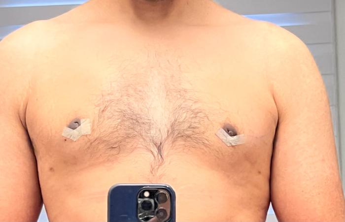 A shirtless person stands in front of a mirror, with small pieces of tape on both nipples and a smartphone partially visible at the bottom of the image.