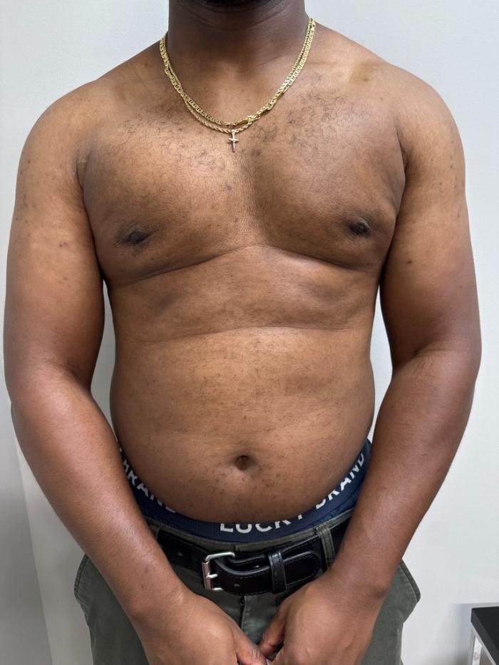 A shirtless man standing against a white background, wearing a gold chain necklace and green pants with a visible belt and waistband.