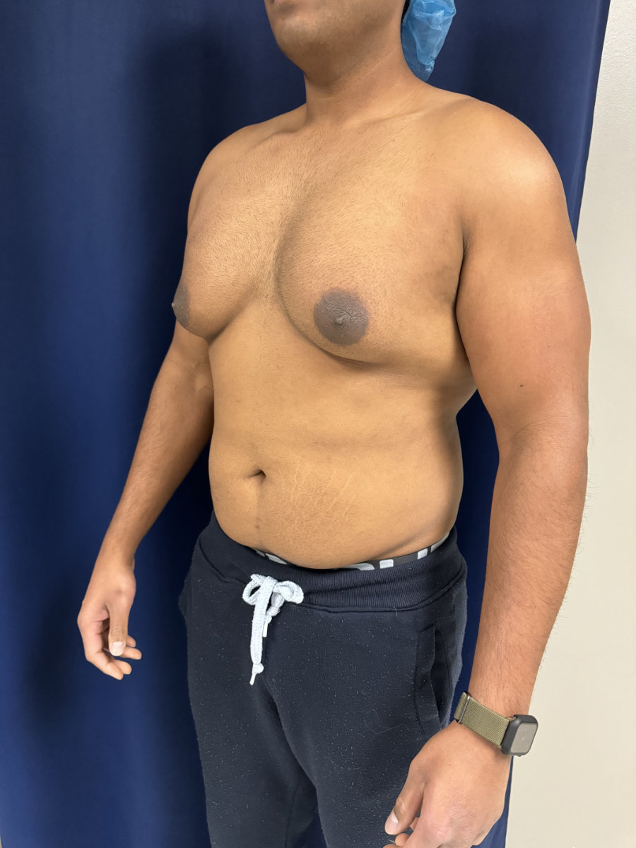 A man stands shirtless in front of a dark curtain, wearing a blue surgical cap, black pants with a drawstring, and a smartwatch on his left wrist.