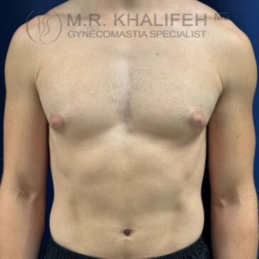 A shirtless male torso facing forward against a dark blue background, with the logo and text "M.R. Khalifeh, MD Gynecomastia Specialist" overlaid at the top.