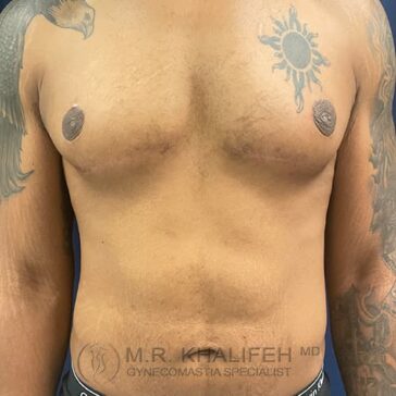 Shirtless male torso with tattoos on both shoulders and upper arms, showing flat chest and visible areolas.