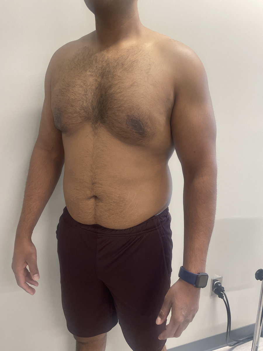 A man wearing burgundy shorts and a smartwatch stands shirtless against a plain wall, with part of his face out of frame.