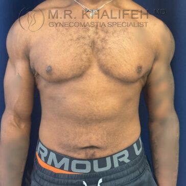 A shirtless man stands facing forward against a blue background, displaying his chest and abdomen. "M.R. Khalifeh MD Gynecomastia Specialist" is written at the top of the image.