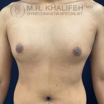 A bare-chested person stands facing forward; logo above reads "M.R. Khalifeh MD, Gynecomastia Specialist.