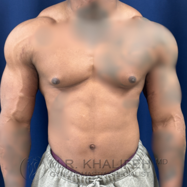 Shirtless person standing against a blue background, showing a muscular chest and torso, with arms relaxed at their sides.