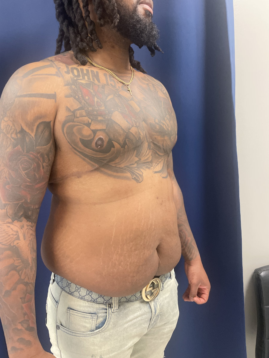 A man with tattoos on his upper body and arms stands shirtless in front of a blue curtain, showing his torso and abdomen.