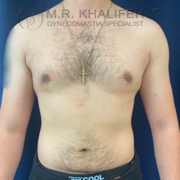 Shirtless male torso facing forward, wearing a gold necklace with a cross pendant, in front of a blue background. Text at the top reads "M.R. Khalifeh MD Gynecomastia Specialist.