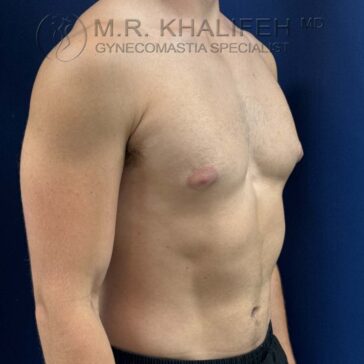 A shirtless man stands in profile against a blue background, showing his chest and torso.