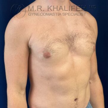 Shirtless male torso shown from the left angle against a dark blue background; some chest hair is visible.