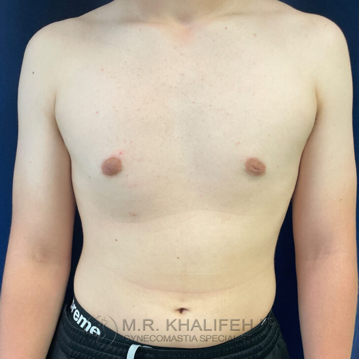 A person with a bare chest and minimal body hair is shown from the waist up, standing against a dark background.