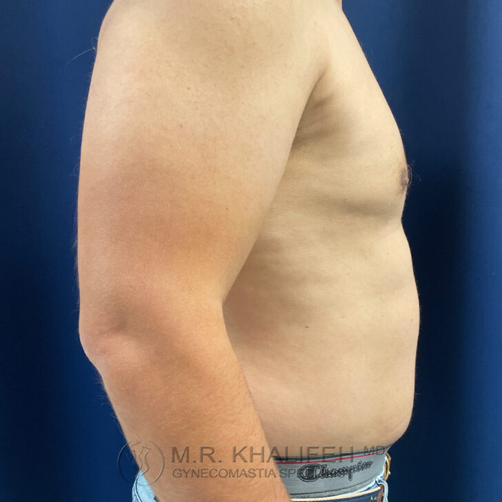A side view of a shirtless male torso standing against a blue background, with arms relaxed and slight abdominal protrusion visible.