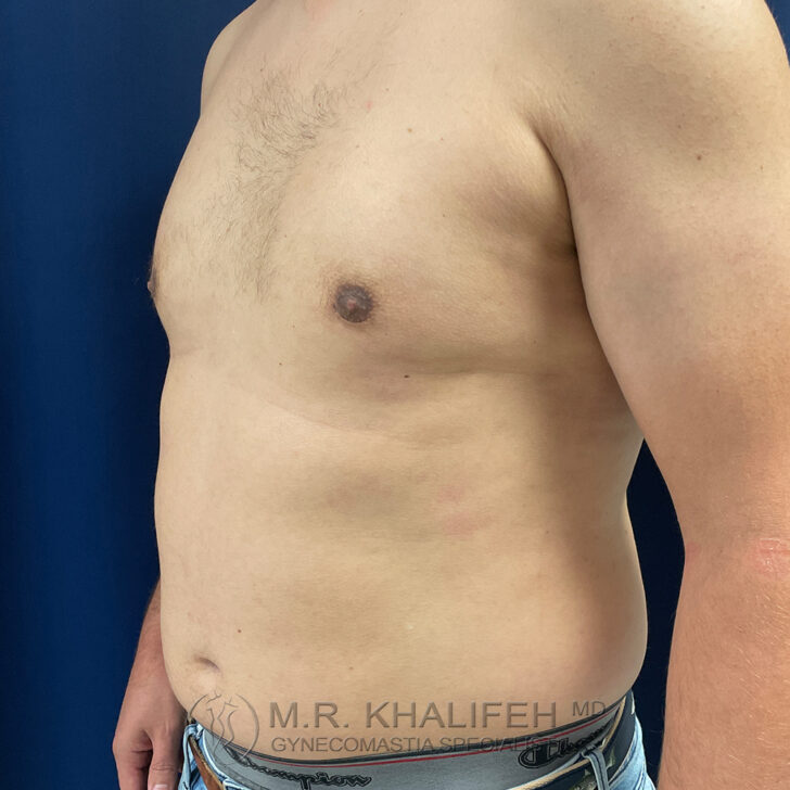 A shirtless person standing sideways, showing their chest and abdomen against a blue background.