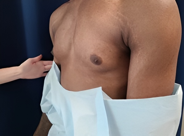 A person wearing a medical gown is being examined; another person's hand is positioned near their chest against a blue background.