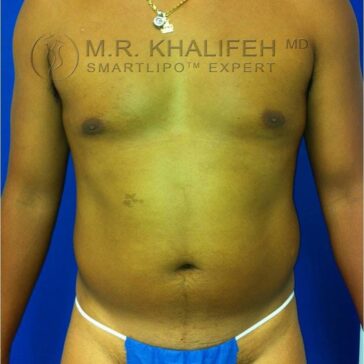 A man stands against a blue background wearing a gold necklace and blue disposable underwear, showing his bare torso.