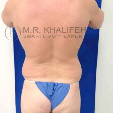 A person stands with their back facing the camera, wearing blue disposable underwear, showing their bare back and sides against a blue background.