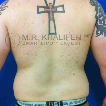 Person's bare back with a large cross tattoo on the upper back, some minor skin blemishes, and part of a tribal tattoo on the right shoulder.