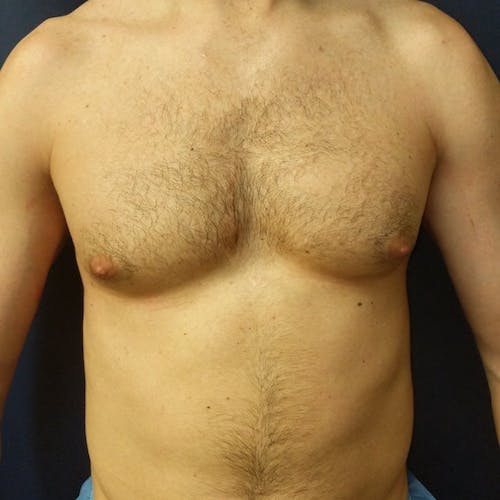 A shirtless adult male torso with visible chest and abdominal hair, standing against a plain dark background.