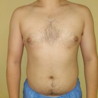 A person with a bare torso is standing upright, facing forward, wearing blue shorts against a plain beige background.