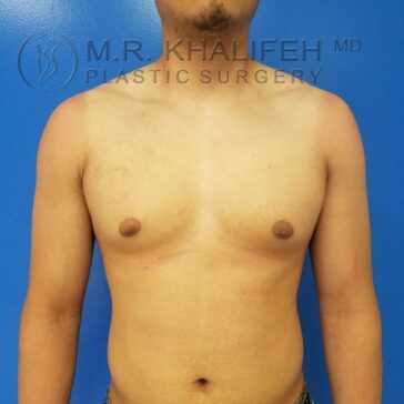 A shirtless person stands against a blue background, showing a tan line across the shoulders and chest, with arms relaxed at their sides.