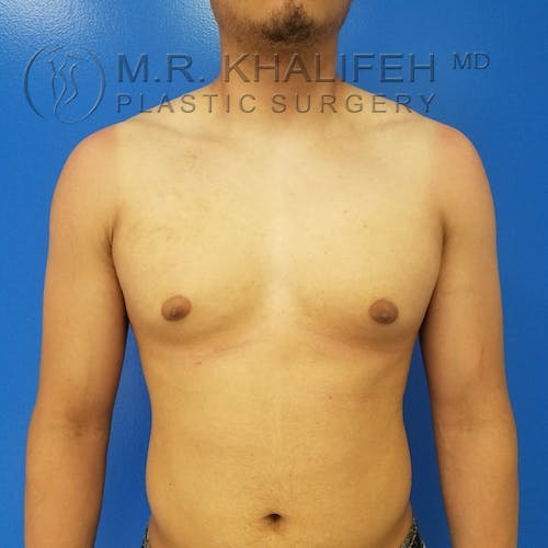 A shirtless person stands against a blue background, showing a tan line across the shoulders and chest, with arms relaxed at their sides.
