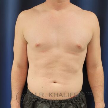 A shirtless adult male stands facing forward against a dark background, showing his upper torso and abdomen.