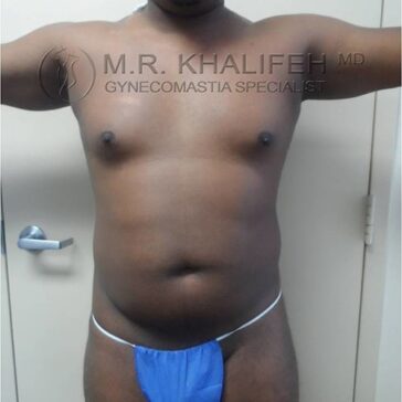 A man with his arms raised, showing his bare chest and abdomen, wearing a blue garment; a clinic door and wall are in the background.
