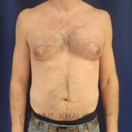 Shirtless adult male standing against a plain dark background, facing forward with arms relaxed at sides.