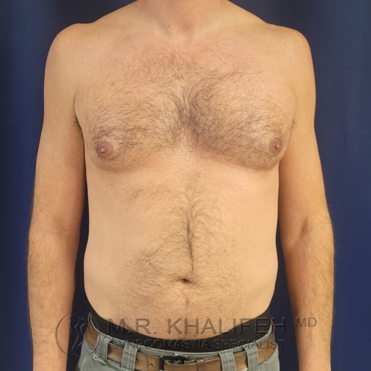 Shirtless adult male standing against a plain dark background, facing forward with arms relaxed at sides.