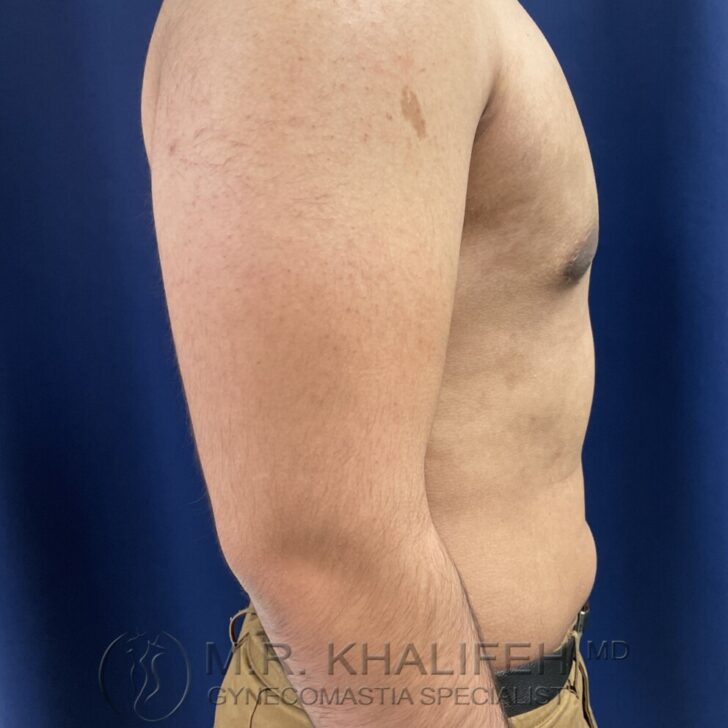 A side view of a shirtless person standing against a blue background, showing the upper arm, chest, and torso.