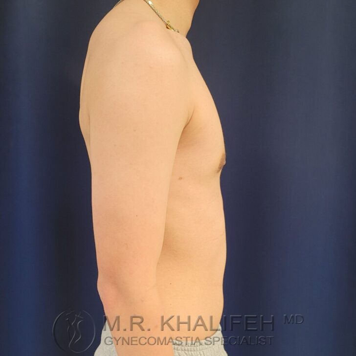 Side view of a shirtless person standing against a dark blue background, with visible watermark text at the bottom.
