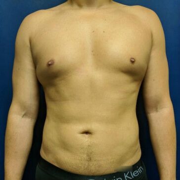 A shirtless adult male stands facing forward against a solid blue background, with arms relaxed by his sides and wearing black underwear.