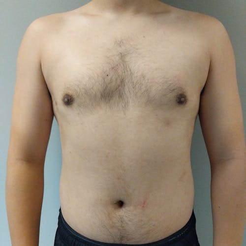 A shirtless person standing against a plain background, showing their chest and abdomen from the shoulders to the waist.