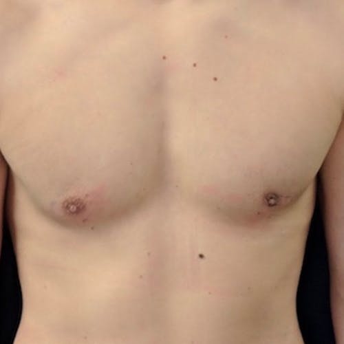 A close-up of a person's bare chest and upper abdomen against a black background.