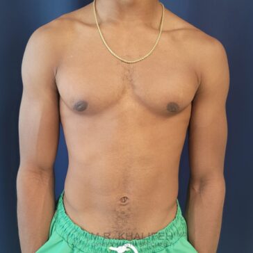A shirtless person wearing a gold chain and green shorts stands against a dark blue background.