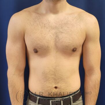 A shirtless man stands against a blue background, facing forward with arms relaxed at his sides.