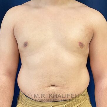 A shirtless person with a bare chest and abdomen stands against a plain dark blue background, wearing tan pants.