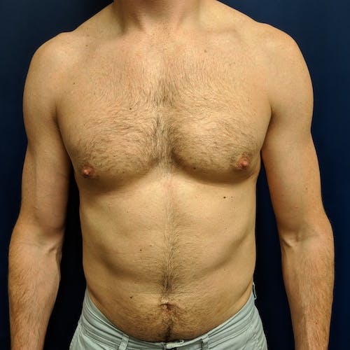 A shirtless adult male torso facing forward against a dark blue background.