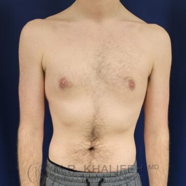 A shirtless person standing against a dark blue background, showing a front view of the chest, abdomen, and upper arms.