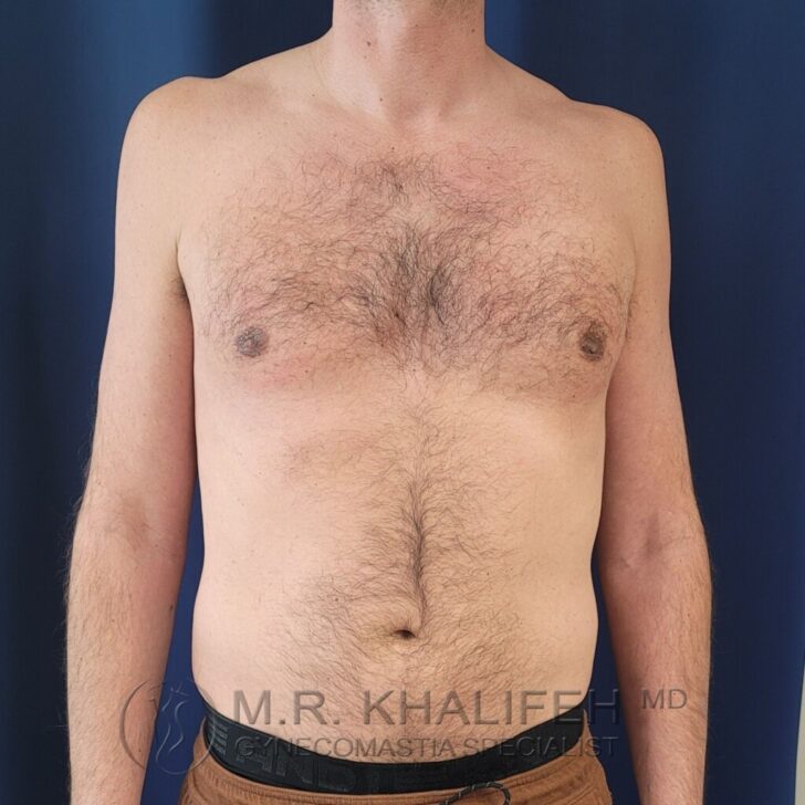 A shirtless adult male stands facing forward against a plain dark blue background, with visible chest and abdominal hair.