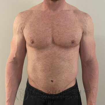 A shirtless adult male stands facing forward against a plain light background, wearing black shorts.
