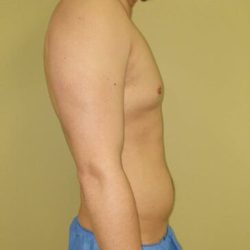 A shirtless person is standing sideways against a plain yellow background, wearing blue shorts.