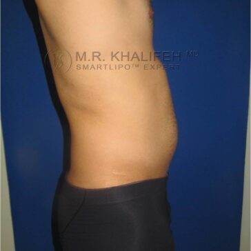 Side view of a person with a slight abdominal bulge, wearing black shorts, standing against a blue background.