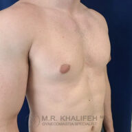 A shirtless adult male torso is shown from the side, with minimal chest hair and a flat chest. The background is plain blue.