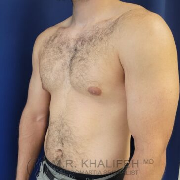 A shirtless man with a beard stands at an angle against a dark blue background, showing his upper body and chest hair.