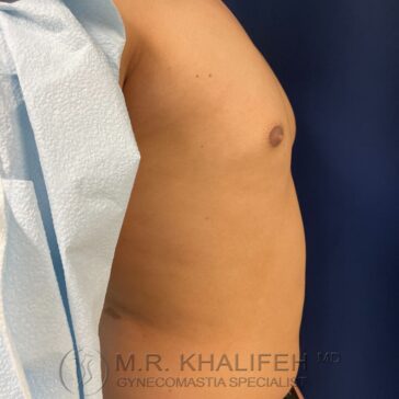 A person's bare chest and torso are partially covered by a medical drape. The image includes a watermark with a doctor's name and title.
