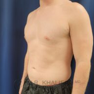 Man with light skin and short hair standing shirtless against a blue background, wearing black shorts, shown from the waist up and angled slightly to the side.