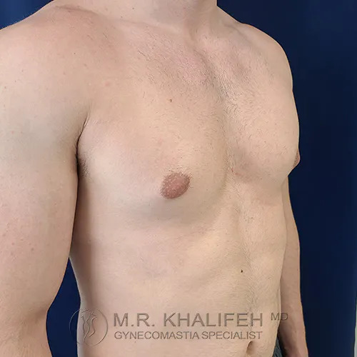 A shirtless adult male torso is shown from the side, with minimal chest hair and a flat chest. The background is plain blue.