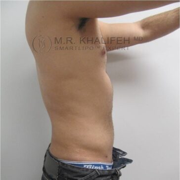 A person stands sideways with their shirt off, exposing their torso and abdomen. Their jeans are slightly lowered, revealing the waistband of blue underwear.