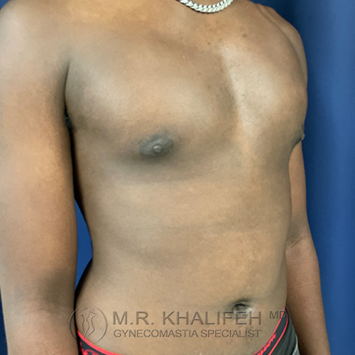 A shirtless person with a bare chest and a visible nipple is shown standing against a blue background.